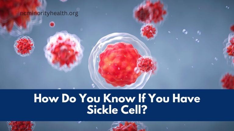 How Do You Know If You Have Sickle Cell?